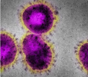 新冠肺炎病毒1 新冠肺炎病毒1